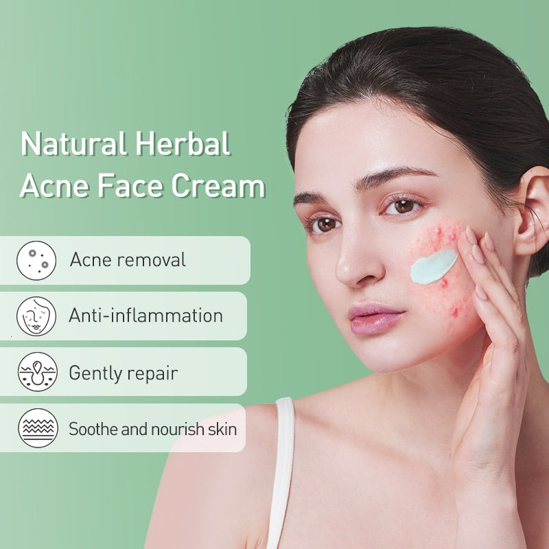 CHYLEANNA  Herbal Pimple Acne Scar Removal Cream
